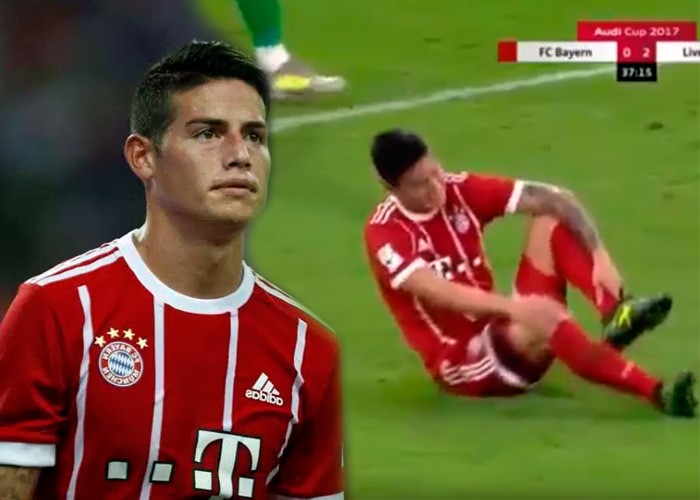 JAMES NO IRA AL MUNDIAL DE RUSIA 2018 TRAS LESIÓN DEL  PASADO 23 DE MARZO