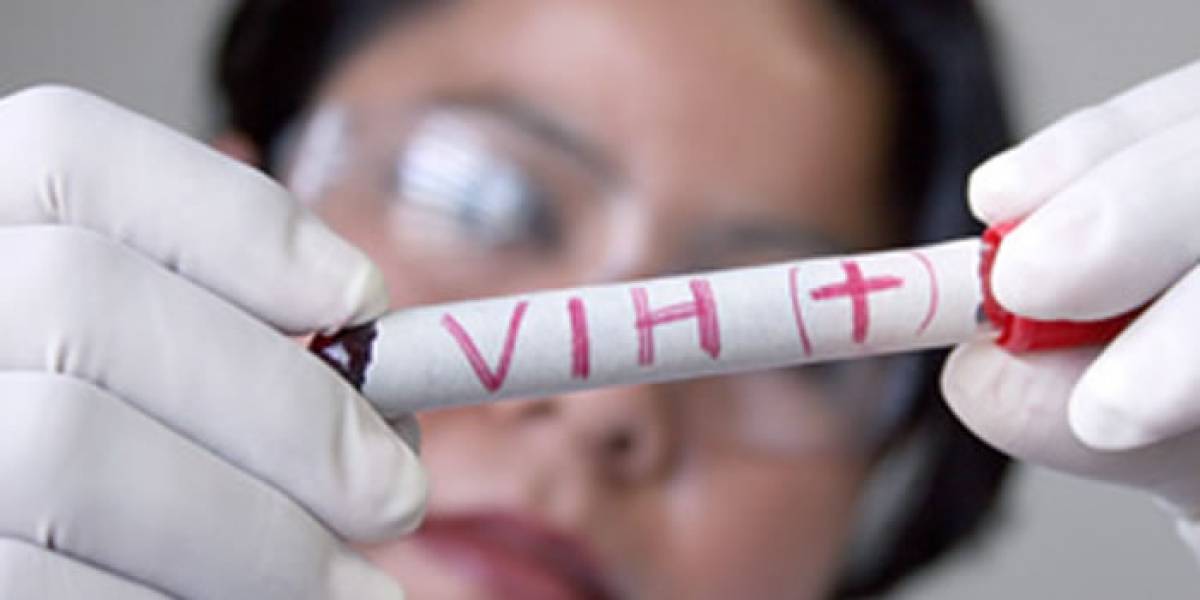 Atención¡ extra¡ Como sacado de una película, a 6 pacientes positivos de Sida han conseguido erradicarles el virus. 