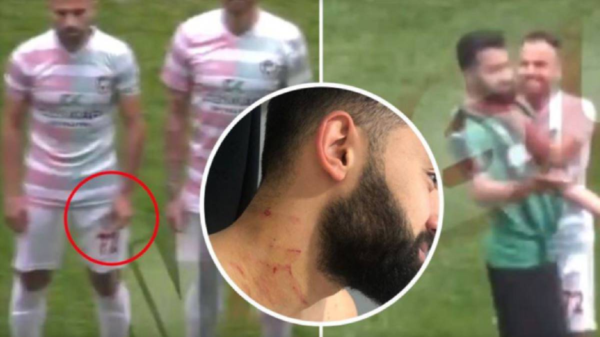 Un jugador agredió a otro con una cuchilla en Turquía