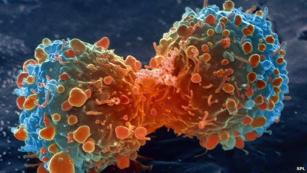 El cáncer se extiende por España