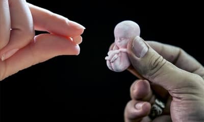 El aborto en la actualidad