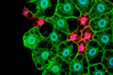 Identifican en moscas una molécula clave para ajustar el consumo de energía cuando falta comida