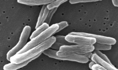 Nuevos datos para el desarrollo de vacunas eficientes contra la tuberculosis