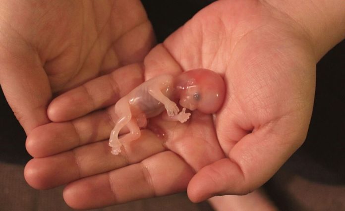 El Aborto