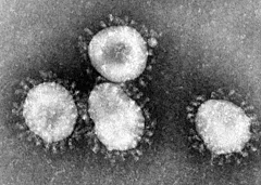 Detectado en España el primer caso de coronavirus