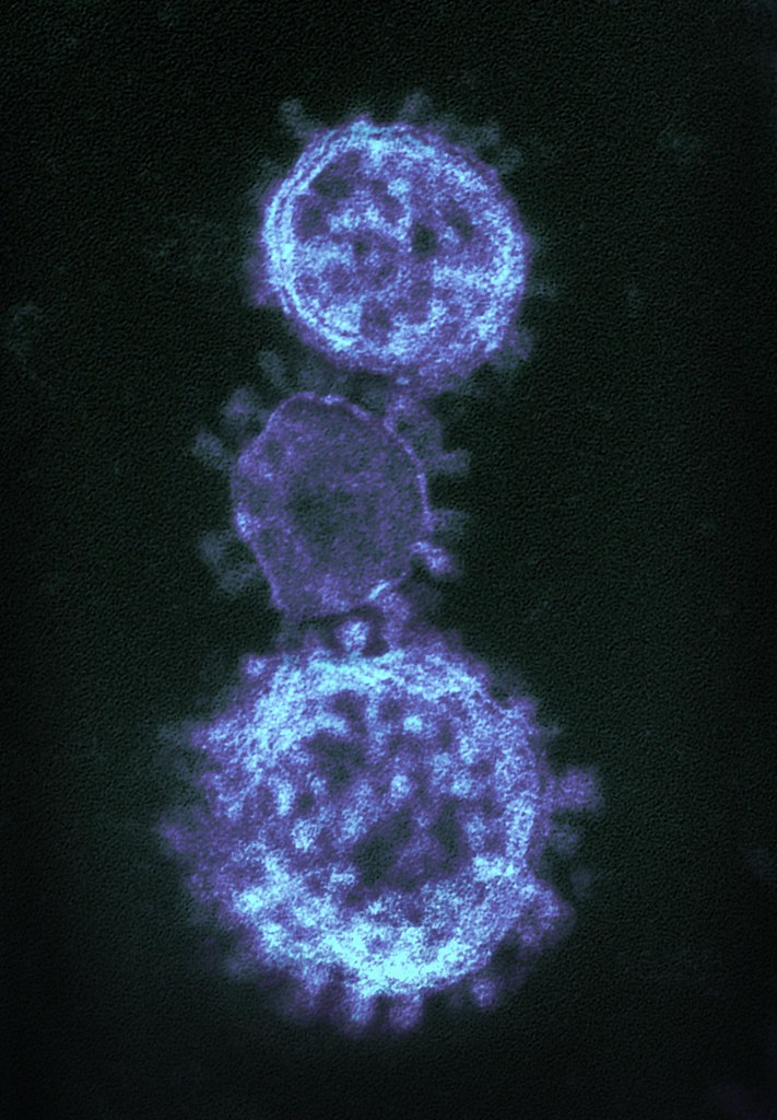 BALANCE DE CORONAVIRUS SUBE A 54 MUERTOS EN CHINA