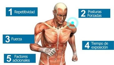 Are you in risk to suffer musculoskeletal disorder?