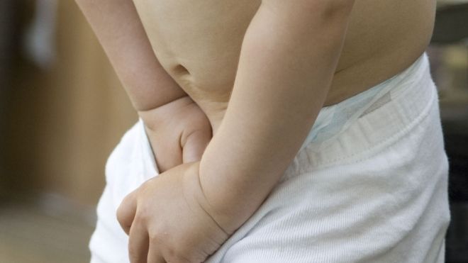 Cortan prepucio a niño: