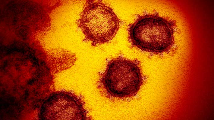 CORONA VIRUS HA LLEGADO A PUEBLA