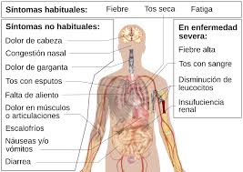 ESTOS SON LOS SINTOMAS