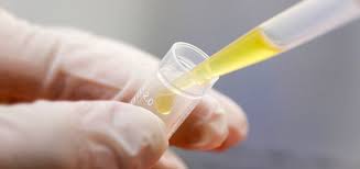 LA MALARIA Y LA CIENCIA
