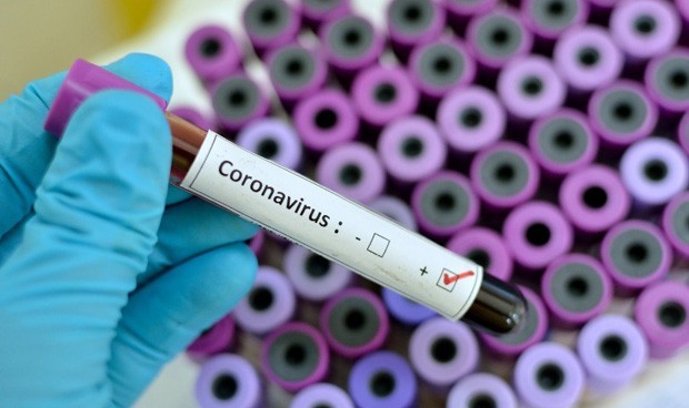 Tres nuevos casos de Coronavirus en el departamento de Córdoba