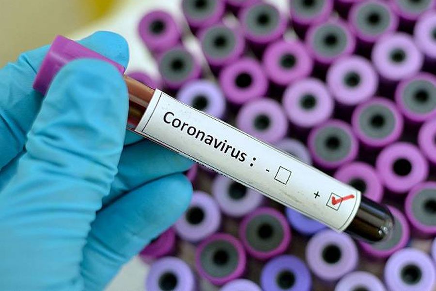 Coronavirus La Nueva Arma De Control Global