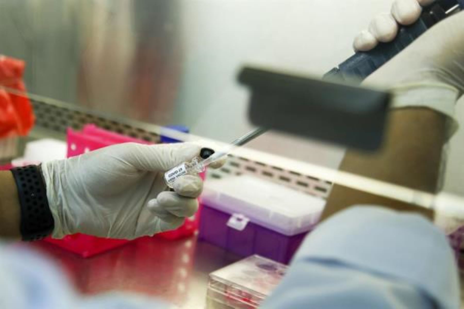 Coronavirus: médico peruano en Estados Unidos usa plasma como terapia para covid-19