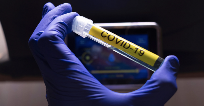 Cepa Brasileña del COVID-19
