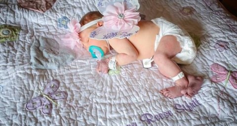 Una niña recién nacida muere días después de contraer un virus de alguien que tenía herpes.