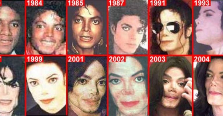 Artículo interesante sobre MJ y el vitiligo