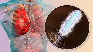 Corrigen mediante edición genética la fibrosis quística