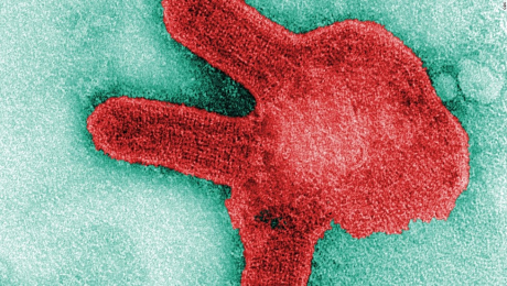 El virus Marburgo entra en acción